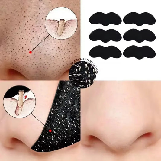 nose black head remover strip