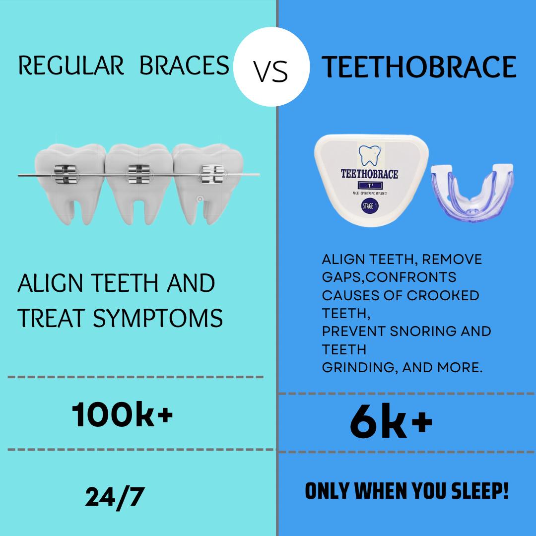 Teethobrace