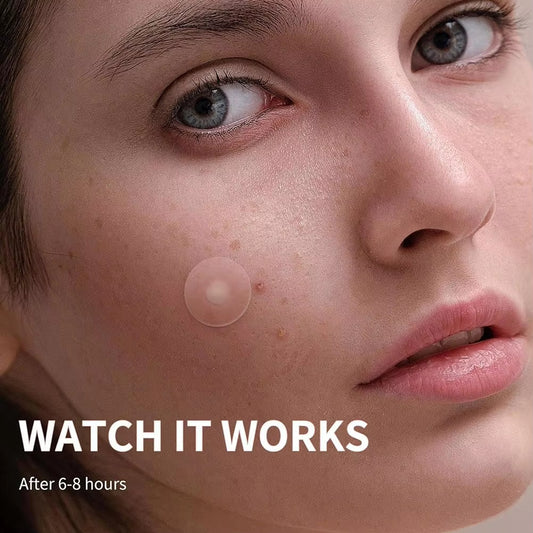 Invisible Removal Pimple Anti-Acne Hydrocolloid Patches