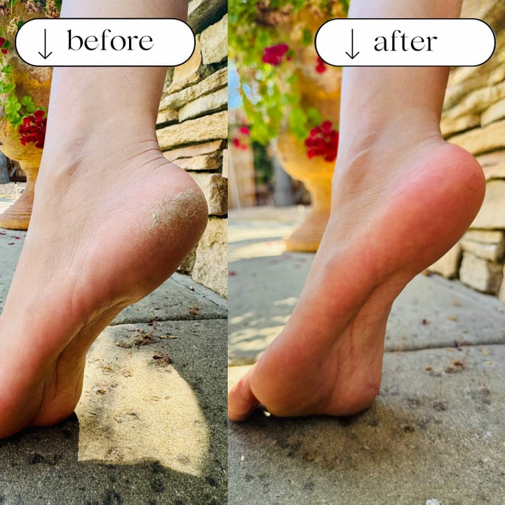 Foot File