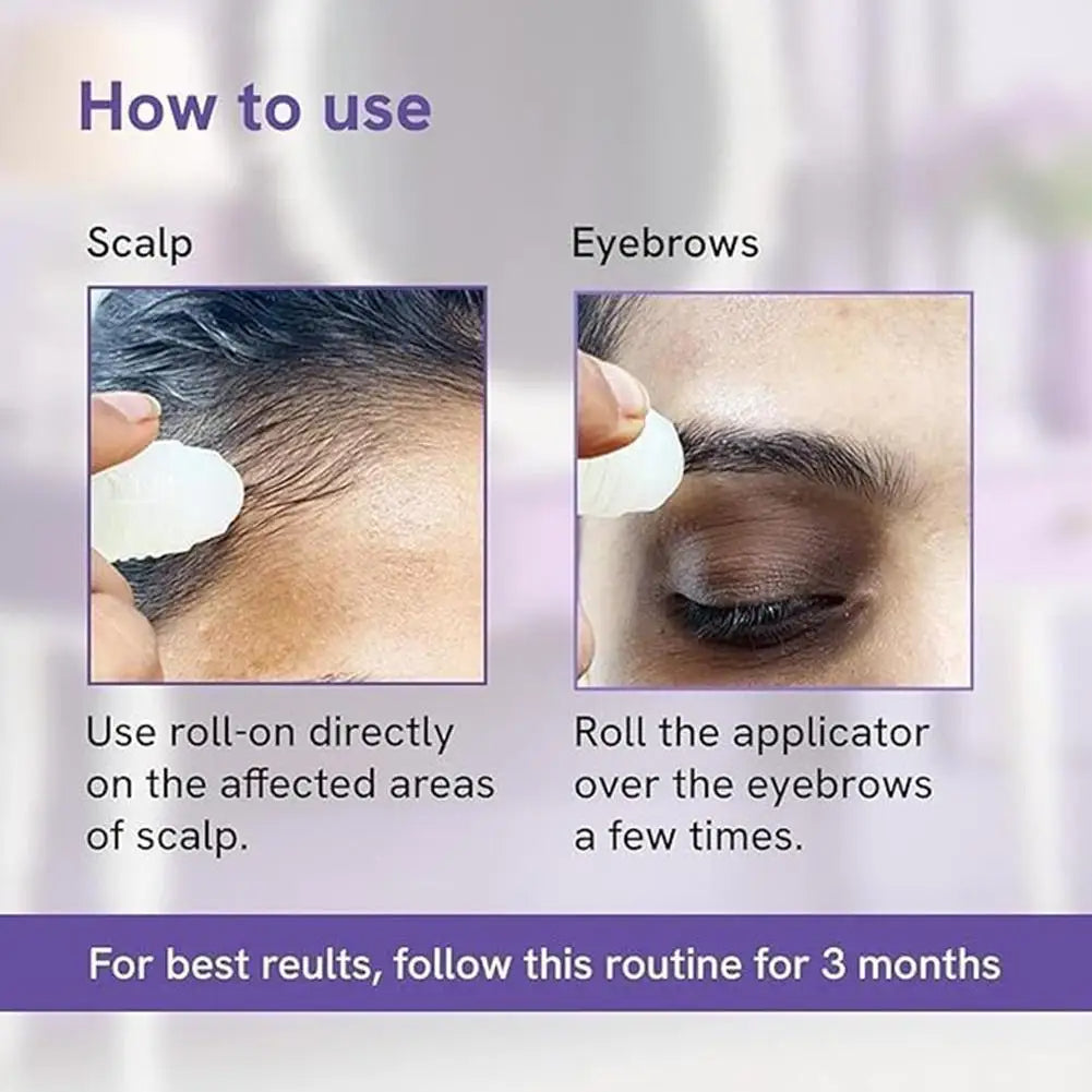 Nourishing Scalp Reboost Roller - Hair Roll-on Serum Roller Growth