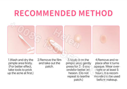🌸 Pimple Patches – Effective Skincare🌸