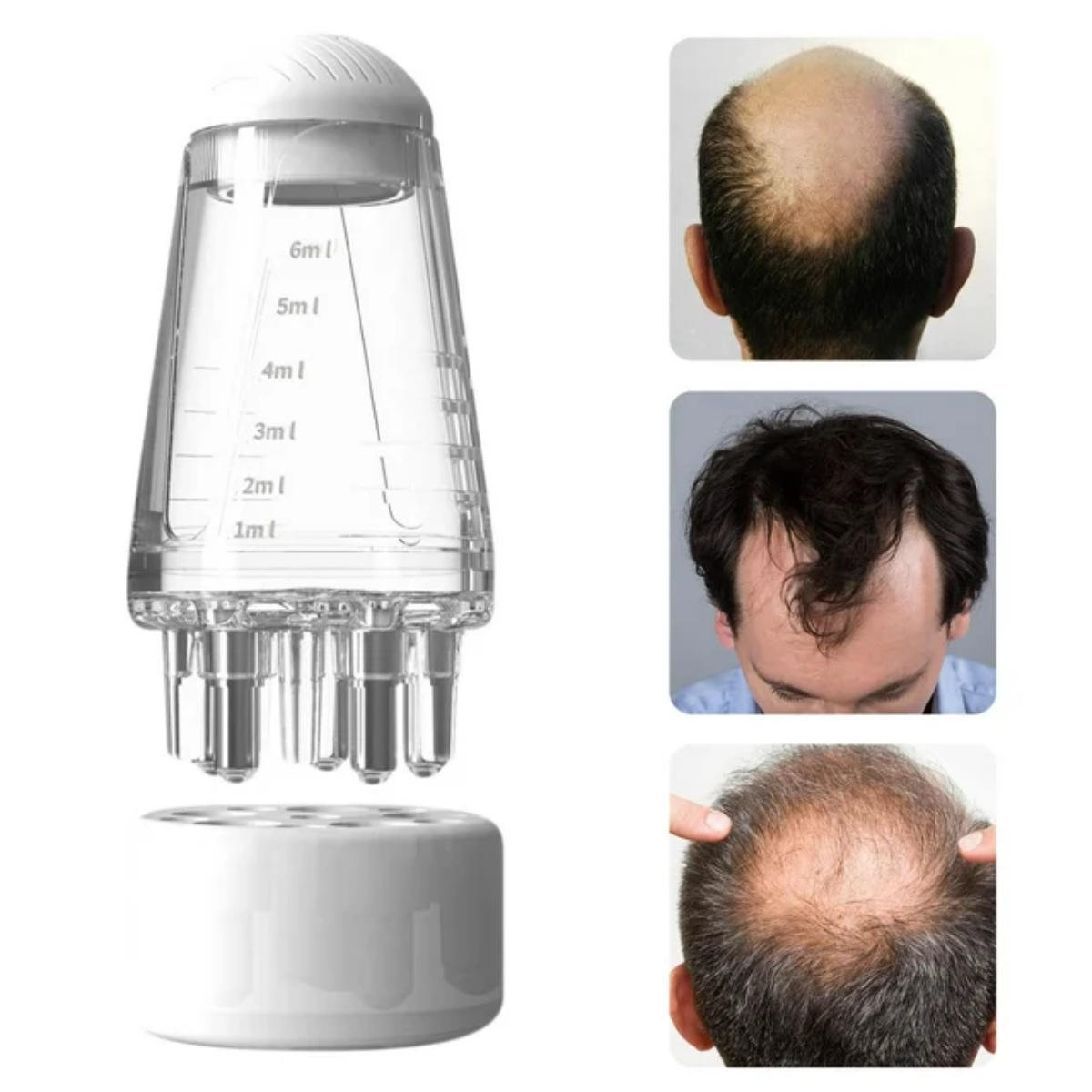 🧴Scalp Oil Applicator with Metal Rollers💧