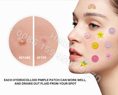 🌸 Pimple Patches – Effective Skincare🌸