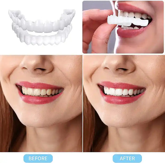 Artificial Teeth Cover Instant