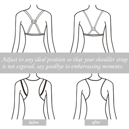 Back Strap Clips