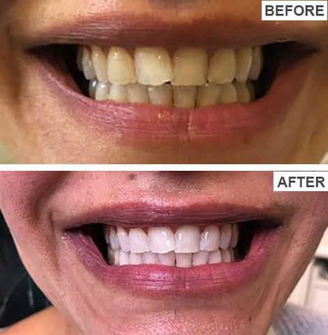 HISMILE V34 TEETH WHITENING SERUM