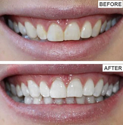 HISMILE V34 TEETH WHITENING SERUM