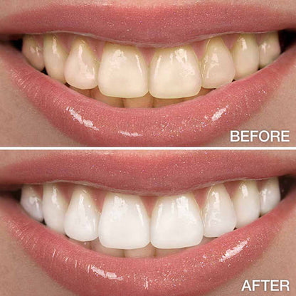 HISMILE V34 TEETH WHITENING SERUM