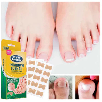Ingrown Toenails and Fungal Infections