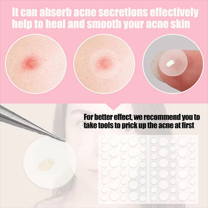 Invisible Removal Pimple Anti-Acne Hydrocolloid Patches