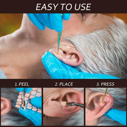 Acupressure Ear Seeds 🌿👂