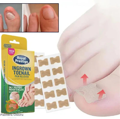 Ingrown Toenails and Fungal Infections