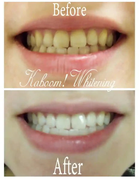 HISMILE V34 TEETH WHITENING SERUM