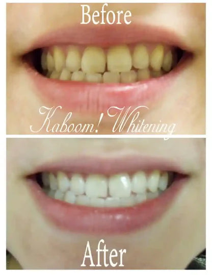 HISMILE V34 TEETH WHITENING SERUM